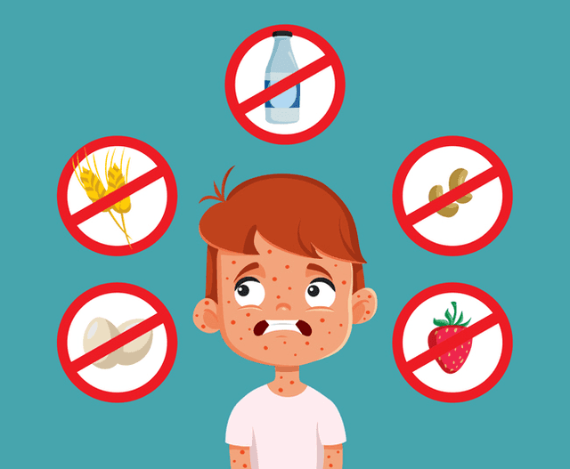 NSW updates allergy and anaphylaxis guidance for ECEC services
